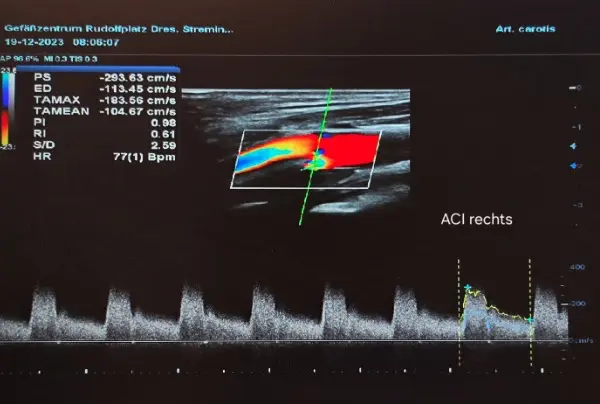 Ultraschalldiagnostik Ultraschalldiagnostik Beispielbild
